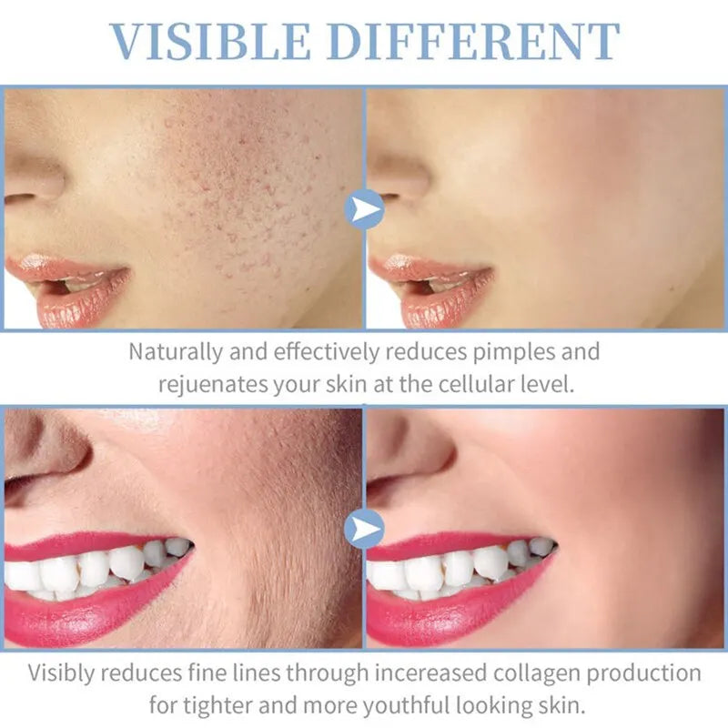 Portable Handheld Skin Therapy Wand Machine