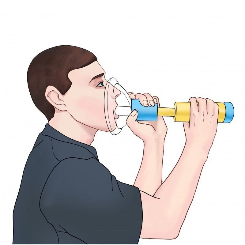 Anti Choking Rescue Device