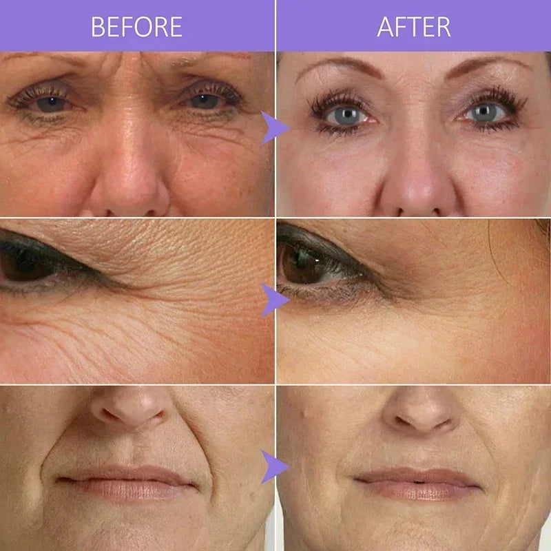 Collagen Face Serum Wrinkle Removal