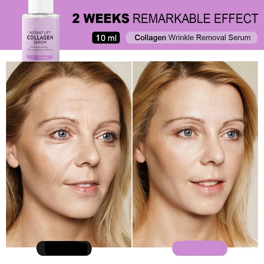 Collagen Face Serum Wrinkle Removal