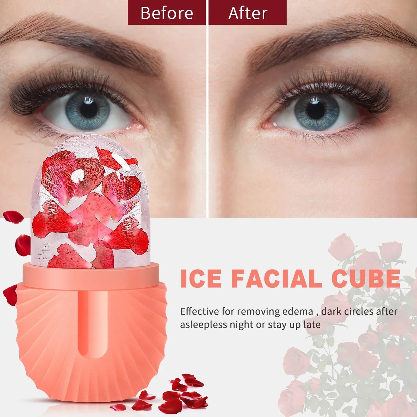 Silicone Ice Cube Trays Acne Skin Care Tool