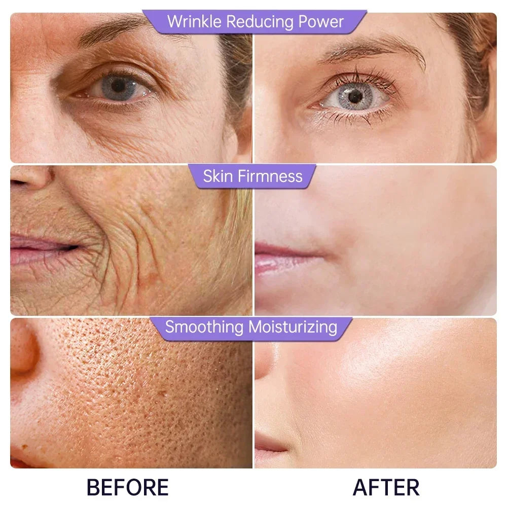 Collagen Face Serum Wrinkle Removal